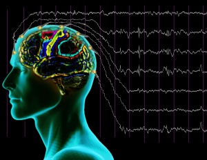 Противопоказания к ЭЭГ при эпилепсии - схема