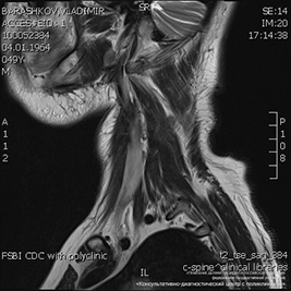 Снимок МРТ мягких тканей шеи