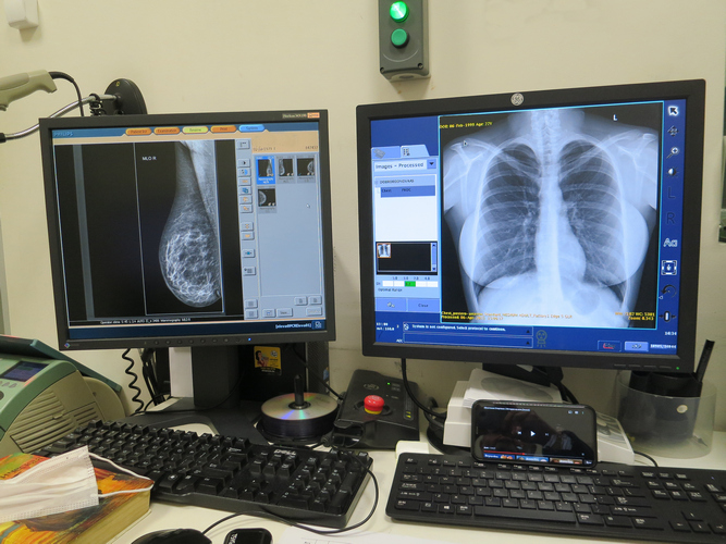 Рентген-снимки на мониторах компьютера врача и рентгенлаборанта